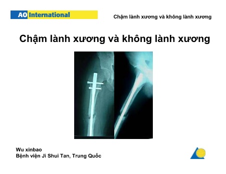 Y khoa, dược - Chậm lành xương và không lành xương